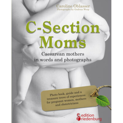 C-Section Moms